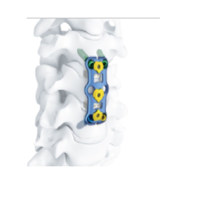 脊柱内窥镜手术器械Spinal Endoscopes Surgical Instruments