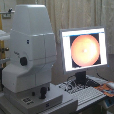 眼底照相机 Digital Fundus Camera