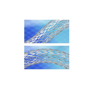 外周血管支架系统Peripheral Vascular Stent System