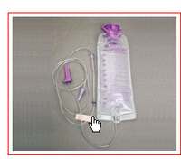 胃肠营养管MIC Transgastric Jejunal Feeding Tube Kit