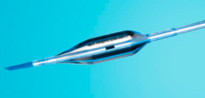 球囊导管Balloon in Balloon(BIB) Catheter