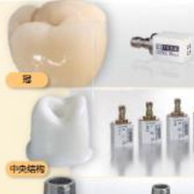 种植体配套用基台及螺钉Abutments and Screws for Implants